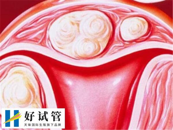 子宫内膜的厚度不是一个固定值