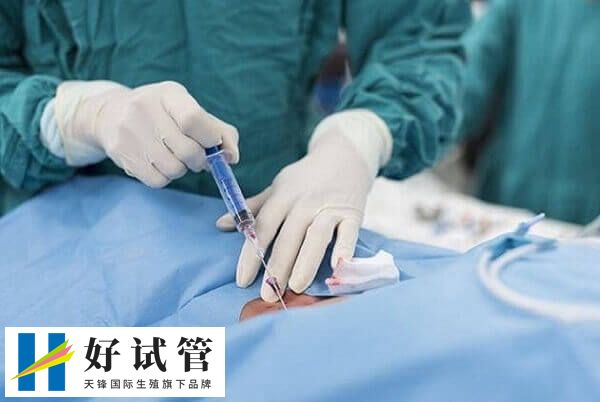 局部麻醉是取卵手术常用麻醉方式