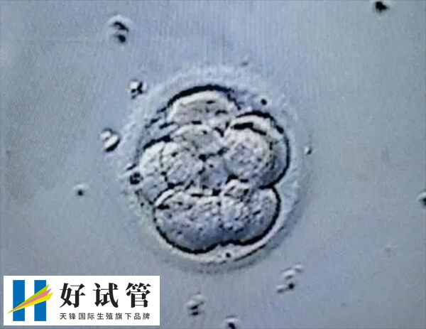 胚胎着床成功的白带颜色为无色透明