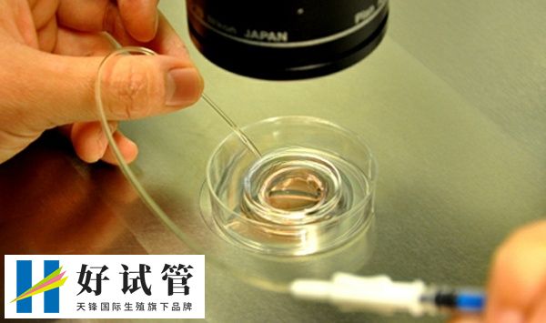 胚胎培养收费并不固定