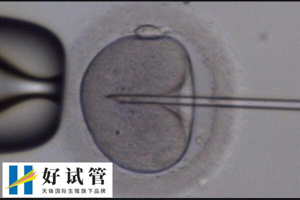 年龄越高卵子质量可能变差